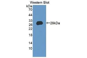 Detection of Recombinant CRISP3, Human using Polyclonal Antibody to Cysteine Rich Secretory Protein 3 (CRISP3) (CRISP3 Antikörper  (AA 21-243))