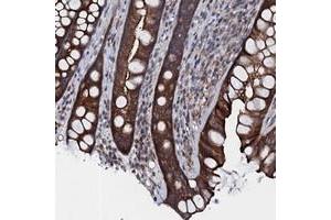 Immunohistochemical staining of human rectum with TMEM151A polyclonal antibody  shows strong cytoplasmic positivity in glandular cells. (TMEM151A Antikörper)