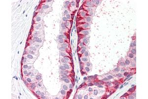 Anti-BRN2 / POU3F2 antibody IHC staining of human prostate. (POU3F2 Antikörper  (C-Term))