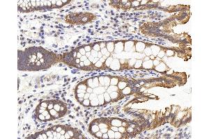 Immunohistochemistry analysis of paraffin-embedded human colon using PERK Polyclonal Antibody at dilution of 1:500. (PERK Antikörper)