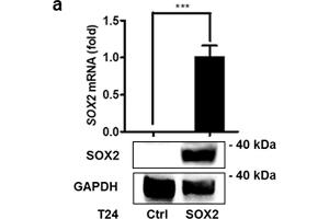 SOX2 mediates growth of bladder cancer cells. (SOX2 Antikörper)