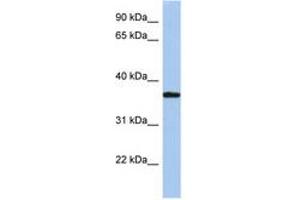 Image no. 1 for anti-Low Density Lipoprotein Receptor Adaptor Protein 1 (LDLRAP1) (AA 35-84) antibody (ABIN6743822) (LDLRAP1 Antikörper  (AA 35-84))