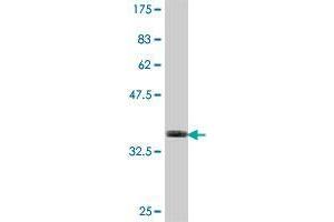 Western Blot detection against Immunogen (35. (COX6B2 Antikörper  (AA 1-88))