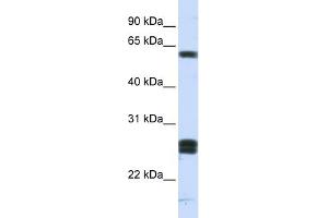 WB Suggested Anti-HABP2 Antibody Titration: 0. (HABP2 Antikörper  (Middle Region))
