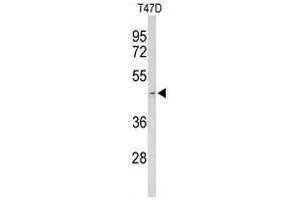 Western blot analysis of ACR Antibody (Center) in T47D cell line lysates (35 µg/lane).
