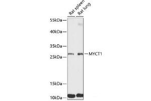 Western blot analysis of extracts of various cell lines using MYCT1 Polyclonal Antibody at dilution of 1:3000. (Myc Target 1 Antikörper)