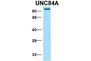 Western Blotting (WB) image for anti-Sad1 and UNC84 Domain Containing 1 (SUN1) (N-Term) antibody (ABIN2783971)