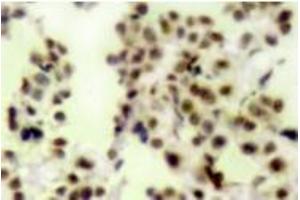 Image no. 2 for anti-Tumor Protein P73 (TP73) (pTyr99) antibody (ABIN318099) (Tumor Protein p73 Antikörper  (pTyr99))