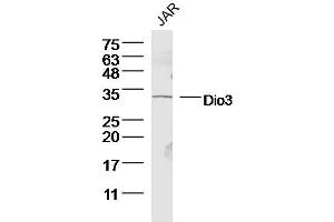 Human JAR lysates probed with Dio3 Polyclonal Antibody, Unconjugated  at 1:300 dilution and 4˚C overnight incubation. (DIO3 Antikörper  (AA 51-150))