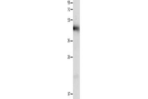 Gel: 12 % SDS-PAGE, Lysate: 40 μg, Lane: Human liver cancer tissue, Primary antibody: ABIN7191316(LRP1 Antibody) at dilution 1/1250, Secondary antibody: Goat anti rabbit IgG at 1/8000 dilution, Exposure time: 40 seconds (LRP1 Antikörper)