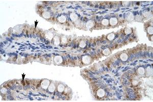 Rabbit Anti-ZNF341 Antibody Catalog Number: ARP30014 Paraffin Embedded Tissue: Human Intestine Cellular Data: Epithelial cells of intestinal villas Antibody Concentration: 4. (ZNF341 Antikörper  (Middle Region))