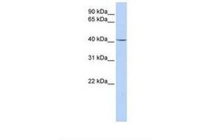 Image no. 1 for anti-Glycerol-3-Phosphate Dehydrogenase 1 (Soluble) (GPD1) (AA 110-159) antibody (ABIN6738025) (GPD1 Antikörper  (AA 110-159))