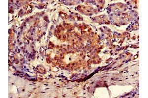 Immunohistochemistry of paraffin-embedded human pancreatic tissue using ABIN7144693 at dilution of 1:100 (ARSG Antikörper  (AA 17-525))