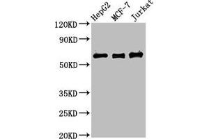 Western Blot Positive WB detected in: HepG2 whole cell lysate, MCF-7 whole cell lysate, Jurkat whole cell lysate All lanes: PRUNE1 antibody at 4 μg/mL Secondary Goat polyclonal to rabbit IgG at 1/50000 dilution Predicted band size: 51, 43, 31, 27, 25, 19 kDa Observed band size: 60 kDa (Exopolyphosphatase PRUNE1 (PRUNE1) (AA 1-168) Antikörper)