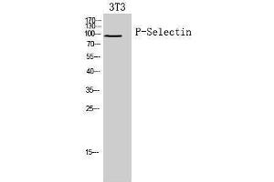 Western Blotting (WB) image for anti-Selectin P (Granule Membrane Protein 140kDa, Antigen CD62) (SELP) (Internal Region) antibody (ABIN6287777)