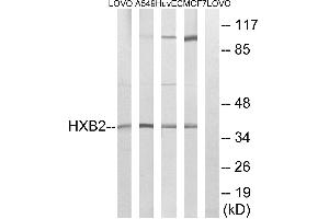 Western blot analysis of extracts from LOVO cells, A549 cells, HUVEC cells and MCF-7 cells, using HOXB2 antibody. (HOXB2 Antikörper  (Internal Region))