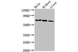 Western Blot Positive WB detected in: Hela whole cell lysate, Mouse kidney tissue, Mouse liver tissue All lanes: MLPH antibody at 3 μg/mL Secondary Goat polyclonal to rabbit IgG at 1/50000 dilution Predicted band size: 66, 63, 53, 61, 51 kDa Observed band size: 66 kDa (Melanophilin Antikörper  (AA 310-539))
