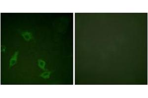 Immunofluorescence analysis of HeLa cells, using FAK (Ab-397) Antibody. (FAK Antikörper  (AA 363-412))