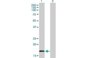 Western Blot analysis of PSCA expression in transfected 293T cell line by PSCA MaxPab polyclonal antibody. (PSCA Antikörper  (AA 1-123))