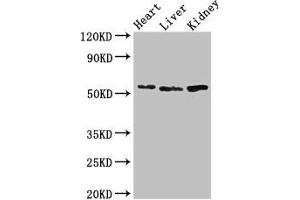 Western Blot Positive WB detected in: Mouse heart tissue, Mouse liver tissue, Mouse kidney tissue All lanes: SOX9 antibody at 3 μg/mL Secondary Goat polyclonal to rabbit IgG at 1/50000 dilution Predicted band size: 57 kDa Observed band size: 57 kDa (SOX9 Antikörper  (AA 296-501))