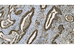IHC analysis of PARP using anti-PARP antibody (ABIN7602276).