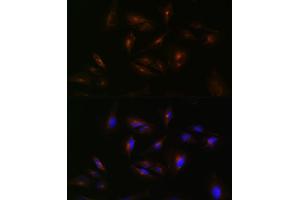 Immunofluorescence analysis of U-251 MG cells using  Rabbit pAb (ABIN7265728) at dilution of 1:100 (40x lens).
