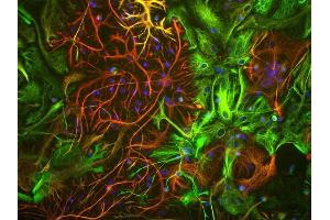 View of mixed neuron/glial cultures stained with ABIN1580468 (green) our rabbit antibody to GFAP antibody (RPCA-GFAP, red). (Vimentin Antikörper)
