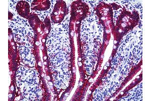 Anti-EPCAM antibody IHC of human intestine. (EpCAM Antikörper)