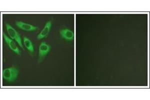 Immunofluorescence analysis of HeLa cells, using S6 Ribosomal Protein. (RPS6 Antikörper  (C-Term))