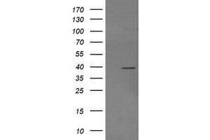 Image no. 2 for anti-Mitogen-Activated Protein Kinase Kinase 3 (MAP2K3) antibody (ABIN1499418) (MAP2K3 Antikörper)
