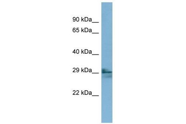 LIM2 Antikörper  (N-Term)
