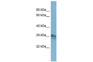 LIM2 antibody used at 1 ug/ml to detect target protein. (LIM2 Antikörper  (N-Term))