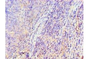 Immunohistochemistry of paraffin-embedded human tonsil tissue using ABIN7153301 at dilution of 1:100 (GRK6 Antikörper  (AA 1-170))