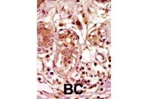 Immunohistochemistry (Paraffin-embedded Sections) (IHC (p)) image for anti-Budding Uninhibited By Benzimidazoles 1 Homolog (Yeast) (BUB1) (AA 1043-1073), (C-Term) antibody (ABIN392626)