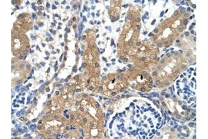 CYP4A22 antibody was used for immunohistochemistry at a concentration of 4-8 ug/ml to stain Epithelial cells of renal tubule (arrows) in Human Kidney.
