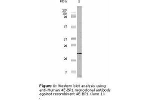 Image no. 1 for anti-Eukaryotic Translation Initiation Factor 4E Binding Protein 1 (EIF4EBP1) antibody (ABIN207632) (eIF4EBP1 Antikörper)