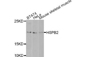 Western blot analysis of extracts of various cell lines, using HSPB2 antibody (ABIN5971309) at 1/1000 dilution.