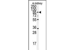 Western blot analysis of anti-AD Antibody (N-term) (ABIN391640 and ABIN2841551) in mouse kidney tissue lysates (35 μg/lane). (ADAM9 Antikörper  (N-Term))