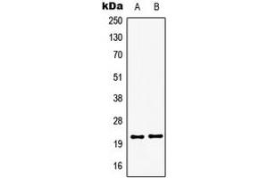 Western blot analysis of GSC2 expression in HepG2 (A), Jurkat (B) whole cell lysates.