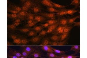 Immunofluorescence analysis of C6 cells using YAP1 Polyclonal Antibody at dilution of 1:100. (YAP1 Antikörper)