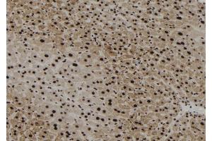 ABIN6256764 and ABIN6267179 at 1/100 staining Mouse liver tissue by IHC-P. (SHP1 Antikörper  (pTyr564))