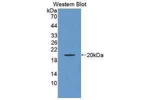 Western blot analysis of the recombinant protein. (BAFF Antikörper  (AA 45-169))