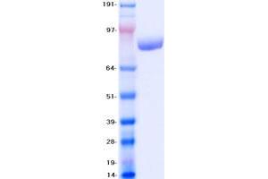 Validation with Western Blot