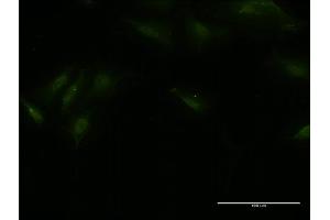 Immunofluorescence of monoclonal antibody to BTBD9 on HeLa cell. (BTBD9 Antikörper  (AA 2-70))