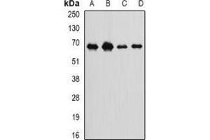 Western blot analysis of Int11 expression in SKOV3 (A), MCF7 (B), mouse spleen (C), rat liver (D) whole cell lysates. (CPSF3L Antikörper)