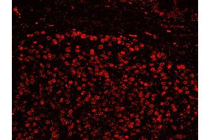 Immunofluorescence (IF) image for anti-Splicing Factor, Arginine/serine-Rich 14 (SFRS14) (AA 725-775) antibody (ABIN7449025)