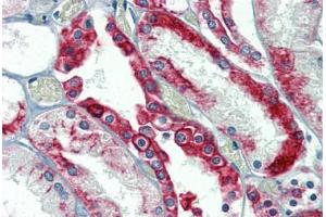 Kidney, Human: Formalin-Fixed, Paraffin-Embedded (FFPE) (Cytokeratin 18 Antikörper)
