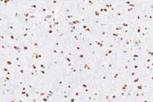 Immunohistochemistry analysis of paraffin-embedded rat substantia nigra using Ring1A (ABIN7075467) at dilution of 1: 3600 (RING1 Antikörper)