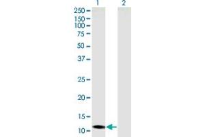 Western Blot analysis of SLC22A18AS expression in transfected 293T cell line by SLC22A18AS monoclonal antibody (M05), clone 4B1.