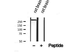 Western blot analysis of extracts from rat brain, using Piezo1 antibody. (PIEZO1 Antikörper  (Internal Region))